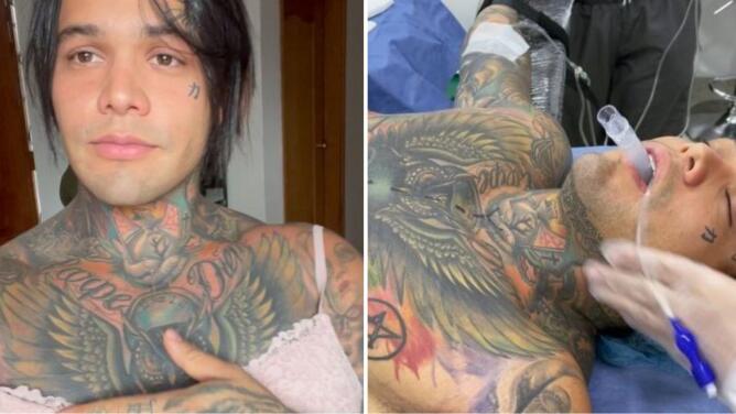 Influencers colombianos despiertan polémica al ponerse implantes de senos por un reto